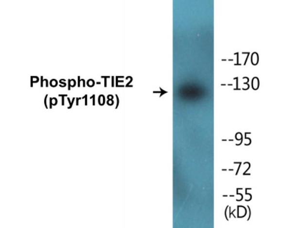 TIE2 Phospho-Tyr1108 Fluorometric Cell-Based ELISA Kit