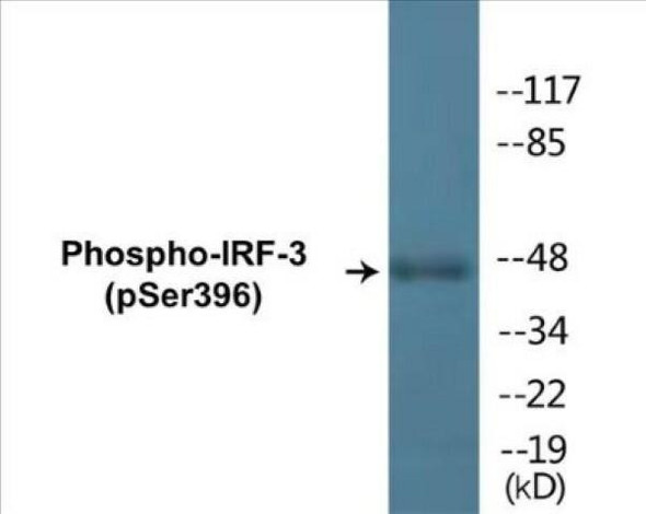 IRF-3 Phospho-Ser396 Fluorometric Cell-Based ELISA Kit