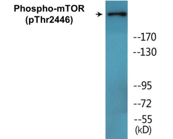 mTOR Phospho-Thr2446 Fluorometric Cell-Based ELISA Kit