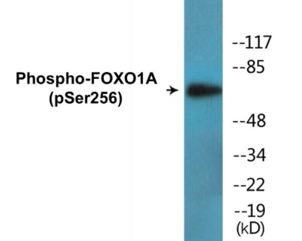 FOXO1A Phospho-Ser256 Fluorometric Cell-Based ELISA Kit