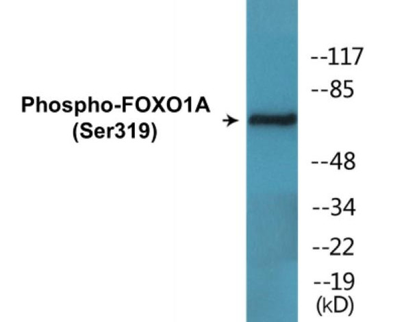 FOXO1A Phospho-Ser319 Fluorometric Cell-Based ELISA Kit