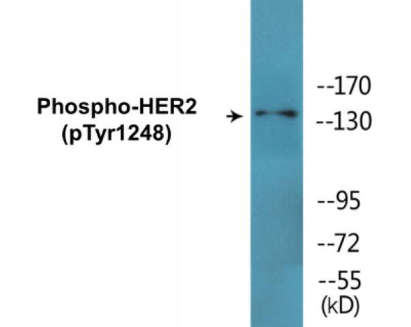 HER2 Phospho-Tyr1248 Fluorometric Cell-Based ELISA Kit