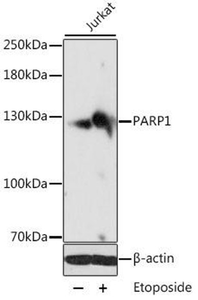 Epigenetics and Nuclear Signaling Antibodies 1 Anti-PARP1 Antibody CAB0010