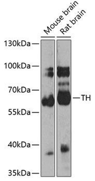 Metabolism Antibodies 1 Anti-TH Antibody CAB0028