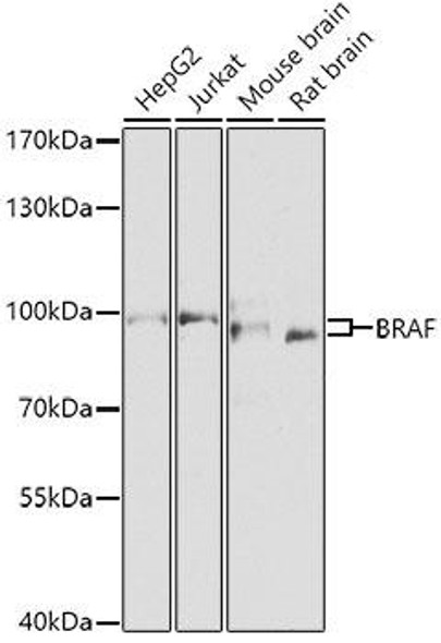 Cell Biology Antibodies 1 Anti-BRAF Antibody CAB0038