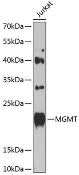 Epigenetics and Nuclear Signaling Antibodies 1 Anti-MGMT Antibody CAB0052