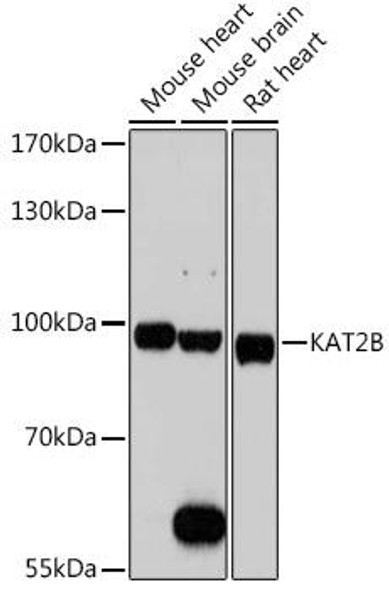 Cell Biology Antibodies 1 Anti-KAT2B Antibody CAB0066