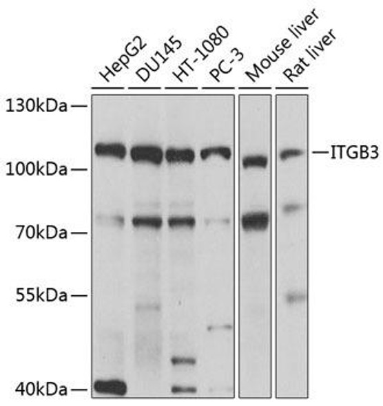 Cell Biology Antibodies 1 Anti-ITGB3 Antibody CAB0076