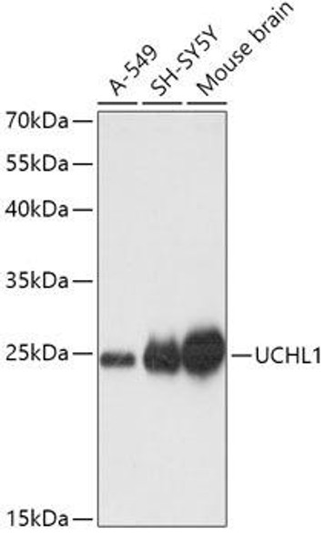 Signal Transduction Antibodies 2 Anti-UCHL1 Antibody CAB0148