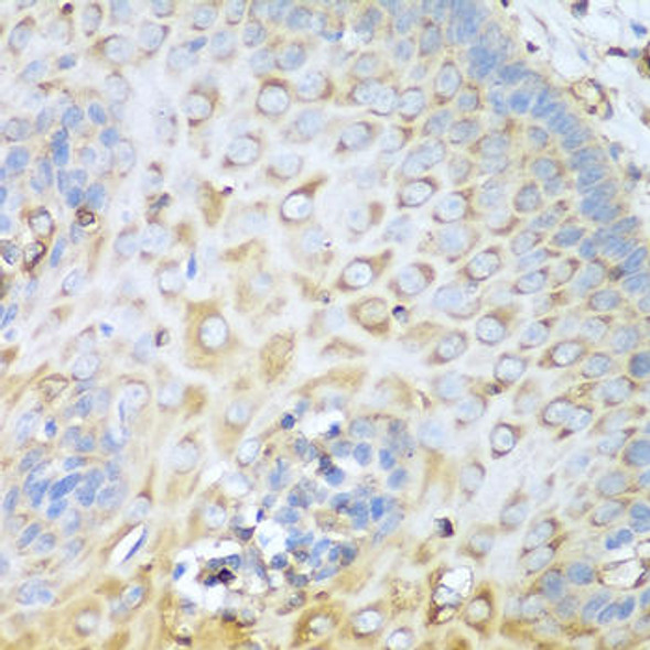 Ki67 Antibody (CAB11390)