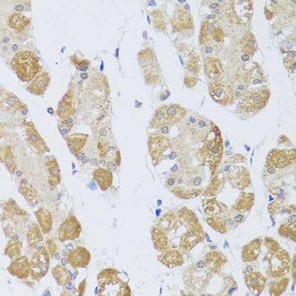 Epigenetics and Nuclear Signaling Antibodies 1 Anti-HDAC4 Antibody CAB0179