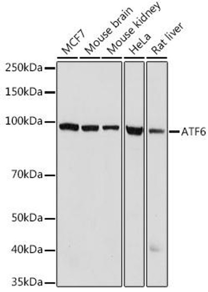Epigenetics and Nuclear Signaling Antibodies 1 Anti-ATF6 Antibody CAB0202