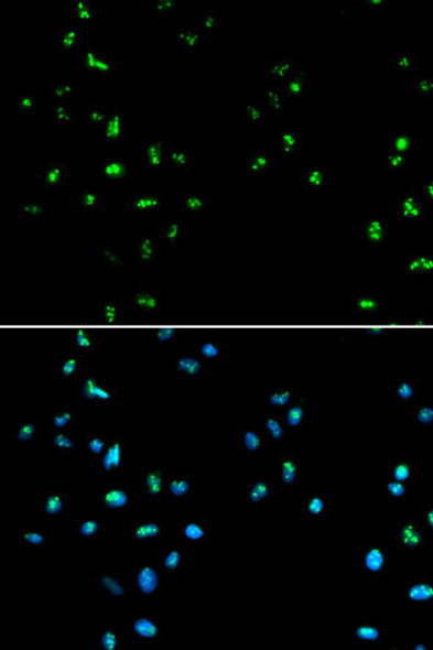 Epigenetics and Nuclear Signaling Antibodies 1 Anti-HDAC4 Antibody CAB0239