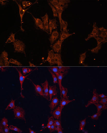 Immunology Antibodies 1 Anti-HSPB1 Antibody CAB0240