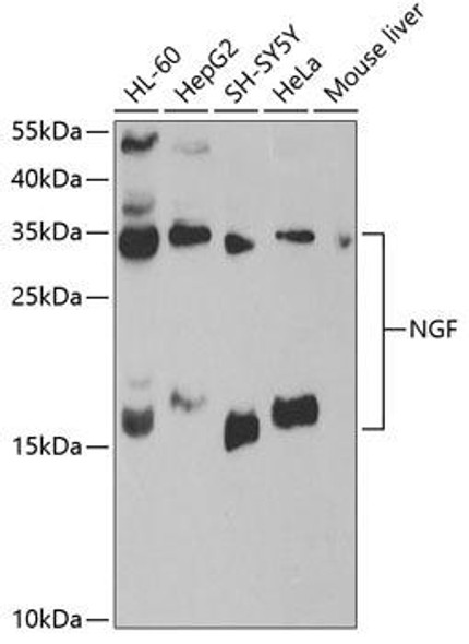 Cell Biology Antibodies 1 Anti-NGF Antibody CAB0258