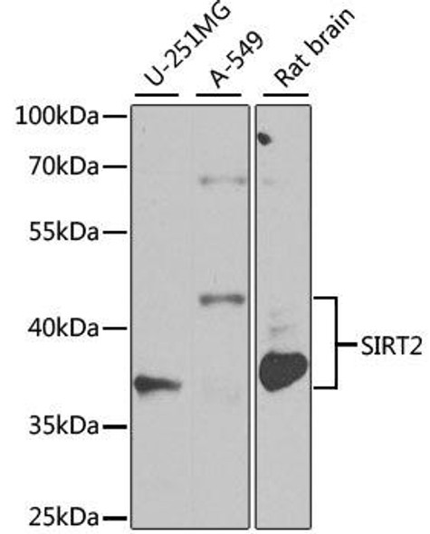 Autophagy Antibodies Anti-SIRT2 Antibody CAB0273