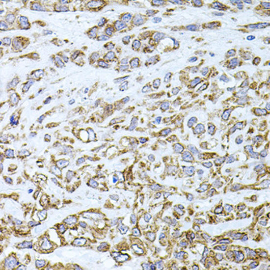 Cell Biology Antibodies 1 Anti-VCAM1 Antibody CAB0279