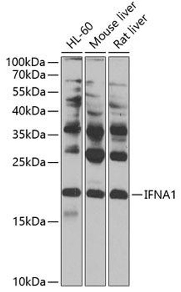 Immunology Antibodies 1 Anti-IFNA1 Antibody CAB0285