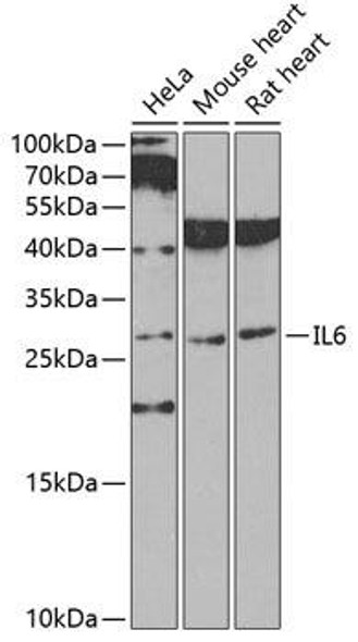 Immunology Antibodies 1 Anti-IL-6 Antibody CAB0286