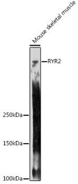 Cell Biology Antibodies 1 Anti-RYR2 Antibody CAB0298