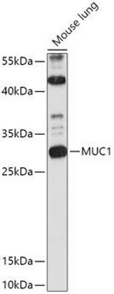 Cell Biology Antibodies 1 Anti-MUC1 Antibody CAB0333