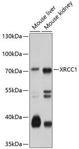 Epigenetics and Nuclear Signaling Antibodies 1 Anti-XRCC1 Antibody CAB0442