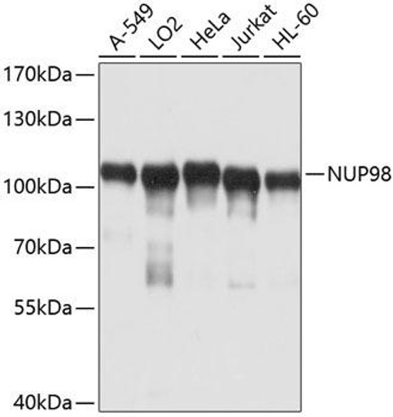 Immunology Antibodies 1 Anti-NUP98 Antibody CAB0530