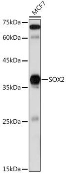 KO Validated Antibodies 1 Anti-SOX2 Antibody CAB0561KO Validated
