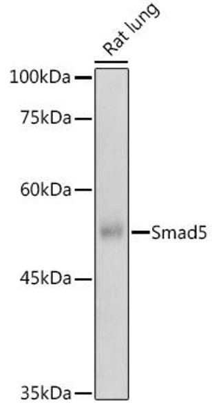 Epigenetics and Nuclear Signaling Antibodies 1 Anti-Smad5 Antibody CAB0635