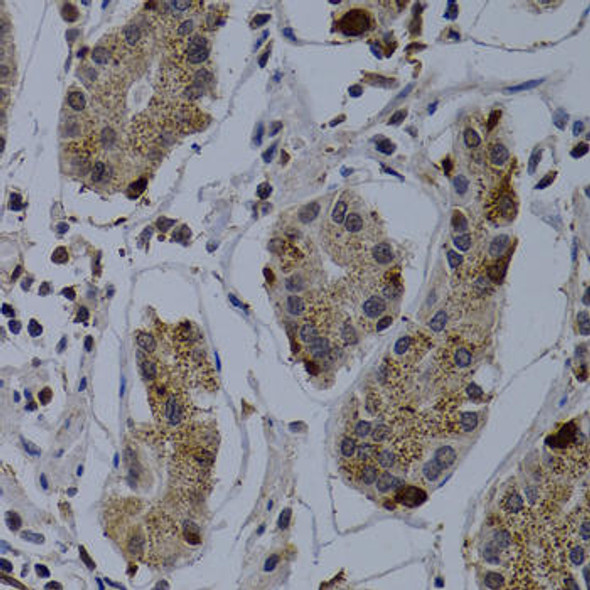 Cell Death Antibodies 1 Anti-TNFRSF6B Antibody CAB0649