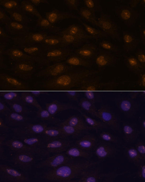 Developmental Biology Anti-MYOD1 Antibody CAB0671