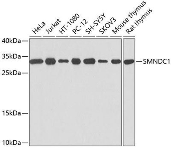 Cell Death Antibodies 1 Anti-SMNDC1 Antibody CAB0681