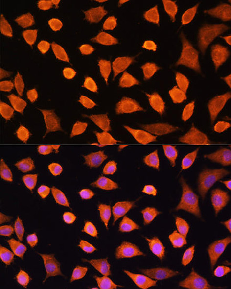 Cell Biology Antibodies 1 Anti-IL-17A Antibody CAB0688