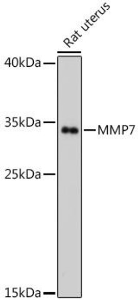 Cell Biology Antibodies 1 Anti-MMP7 Antibody CAB0695