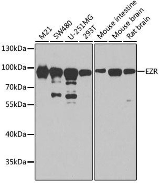 Cell Biology Antibodies 1 Anti-EZR Antibody CAB0703