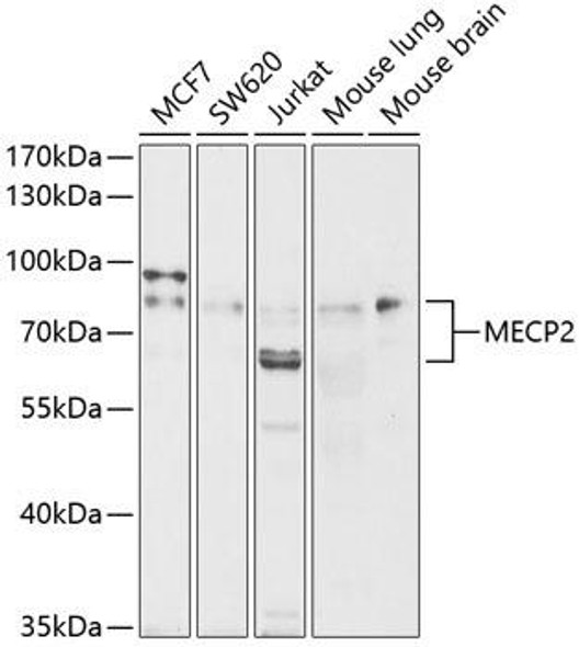 KO Validated Antibodies 1 Anti-MECP2 Antibody CAB0707KO Validated