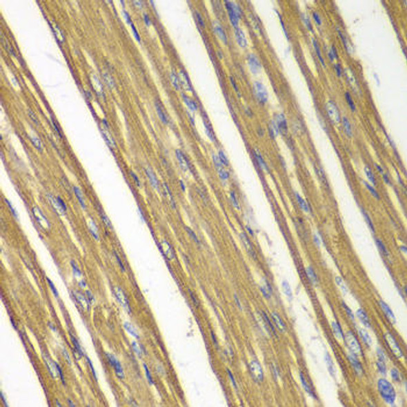 Cell Death Antibodies 1 Anti-Caspase-7 Antibody CAB0716