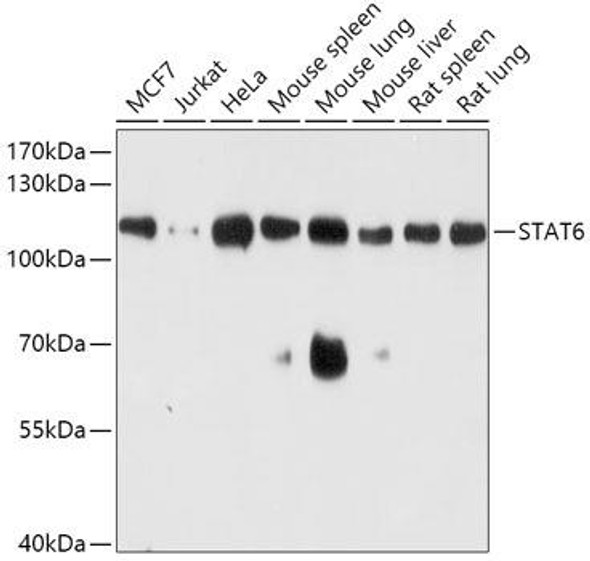 Epigenetics and Nuclear Signaling Antibodies 1 Anti-STAT6 Antibody CAB0755