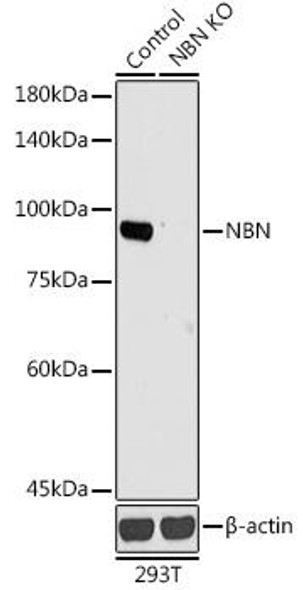 KO Validated Antibodies 1 Anti-NBN Antibody CAB0783KO Validated