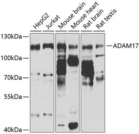 Signal Transduction Antibodies 3 Anti-ADAM17 Antibody CAB0821