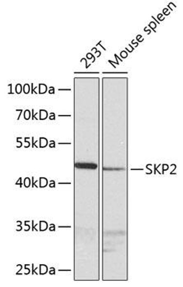 Immunology Antibodies 1 Anti-SKP2 Antibody CAB0842