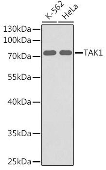 Cell Death Antibodies 1 Anti-TAK1 Antibody CAB0923
