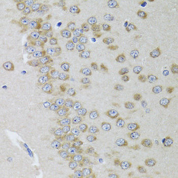 Signal Transduction Antibodies 1 Anti-GRIN2A Antibody CAB0924
