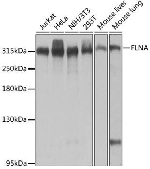 Cell Biology Antibodies 1 Anti-FLNA Antibody CAB0927