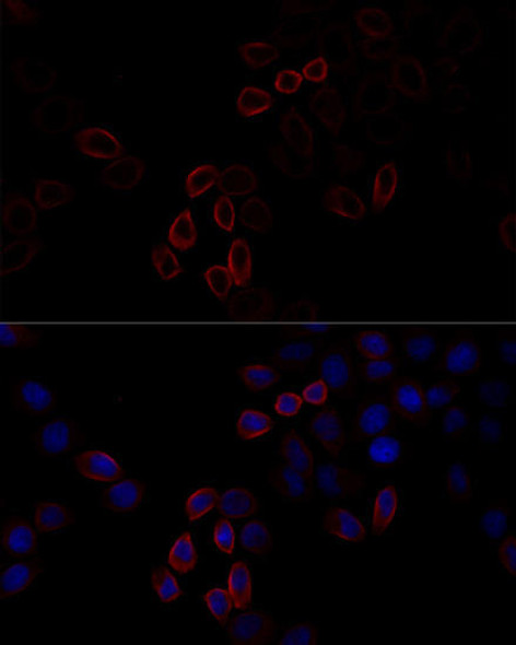 Cell Biology Antibodies 1 Anti-FLNA Antibody CAB0927