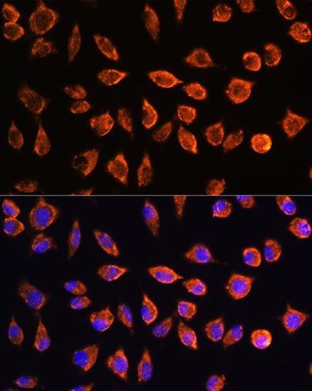Developmental Biology Anti-NOTCH3 Antibody CAB0929