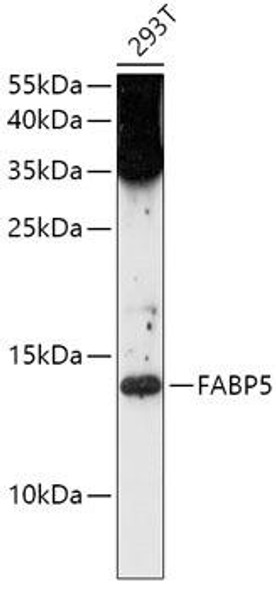 Signal Transduction Antibodies 1 Anti-FABP5 Antibody CAB0947