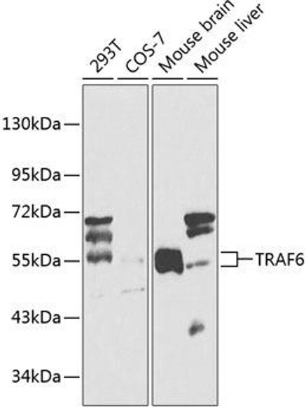 Epigenetics and Nuclear Signaling Antibodies 1 Anti-TRAF6 Antibody CAB0973