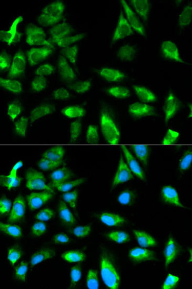 Epigenetics and Nuclear Signaling Antibodies 1 Anti-TRAF6 Antibody CAB0973