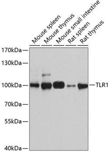 Immunology Antibodies 1 Anti-TLR1 Antibody CAB0997
